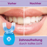 VITALmaxx 360° Schall-Zahnbürste mit LED-Blaulicht & Vibration - Vorher Nachher Vergleich der Zahnaufhellung durch kaltes Licht.