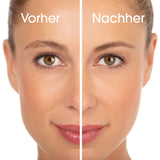 VITALmaxx Haarentferner "Perfect Shave" zeigt Vorher-Nachher Ergebnis für schmerzfreie, rote Haut freie Haarentfernung ohne Mühe.