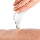 VITALmaxx Porenreiniger - Für reine Gesichtshaut - 4 Aufsätze, extrahiert Unreinheiten effektiv und kabellos für Gesicht, Arme und Beine.