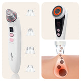 MAXXMEE Gesichtspflege "Professional" 2er-Set mit Porenreiniger und Gesichtsreinigungsgerät für verschiedene Modi und Intensitätsstufen.