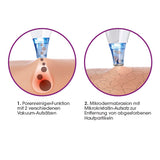 VITALmaxx Porenreiniger 5-tlg. mit Aufsatz für Mikrodermabrasion zur porentiefen Reinigung und Entfernung abgestorbener Hautpartikel.