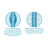 VENENWALKER basic Venen-Therapiegerät zeigt Funktionsweise der Wechseldrucktechnik zur Verbesserung des venösen Rückstroms.