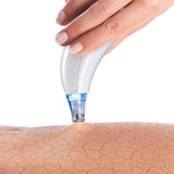 VITALmaxx Porenreiniger 5-tlg. mit Aufsatz für Mikrodermabrasion in Weiß für porentiefe Reinigung und Entfernung abgestorbener Hautpartikel.